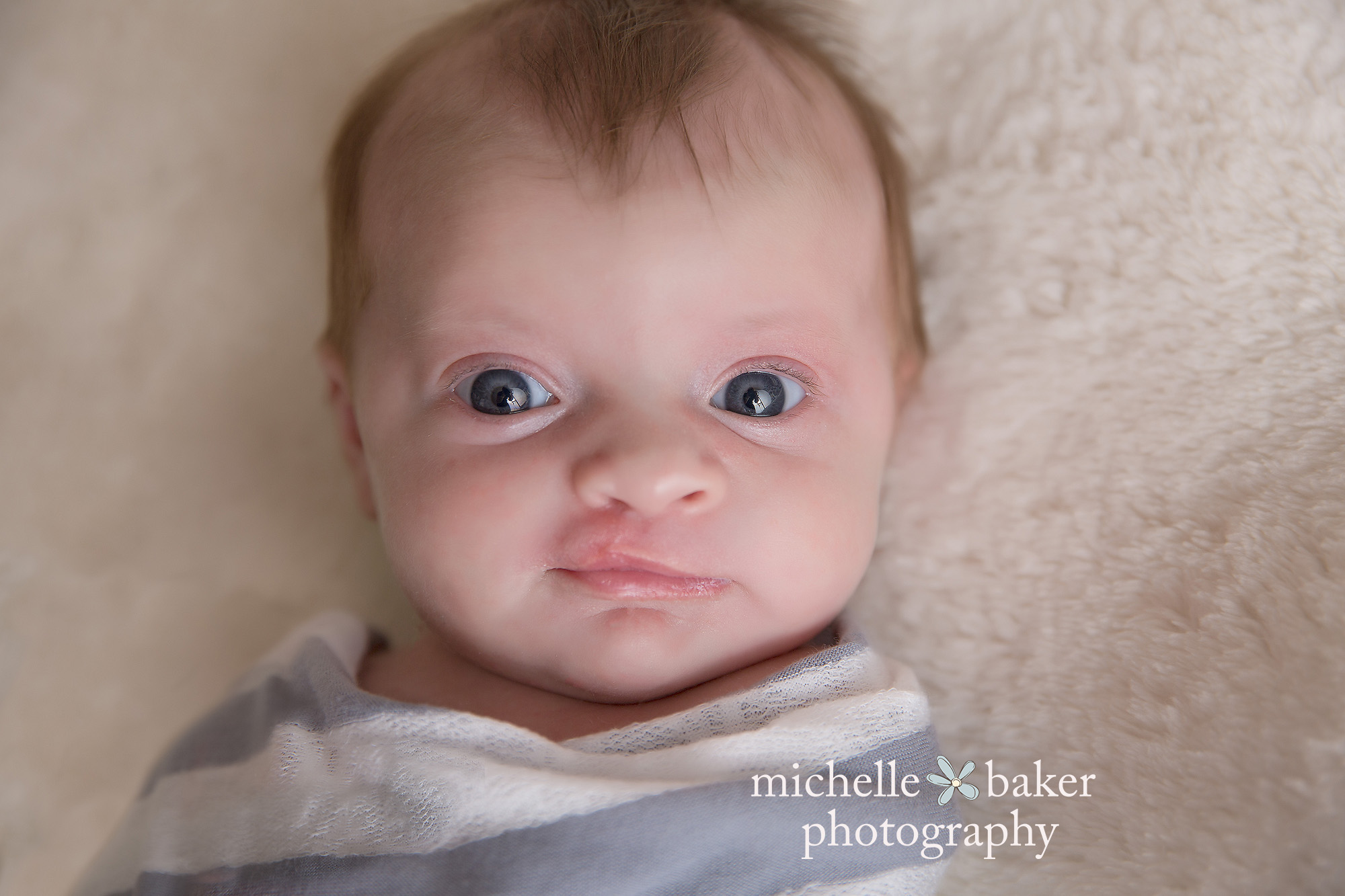 Baby with repaired cleft lip