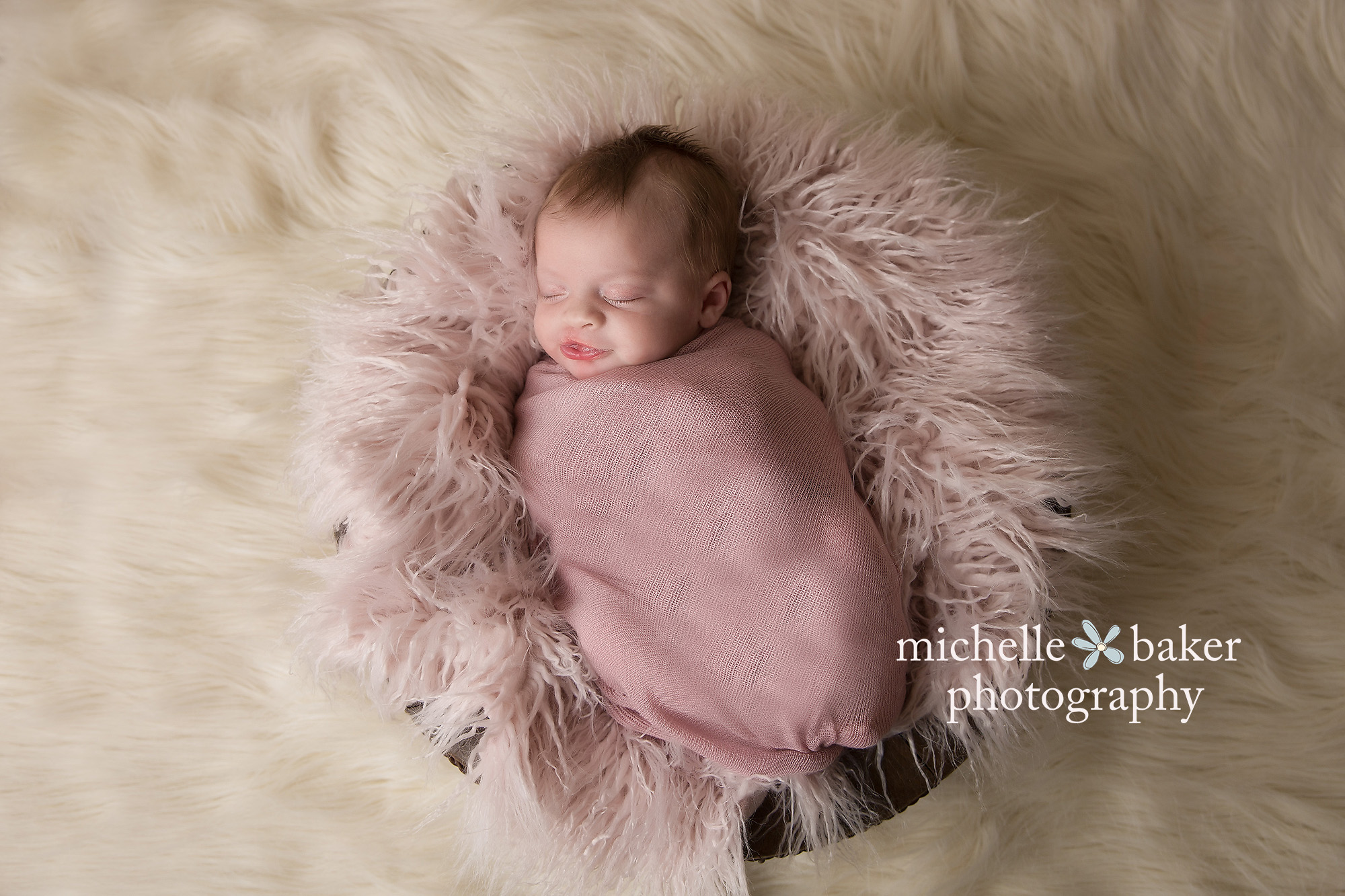 Baby with repaired cleft lip